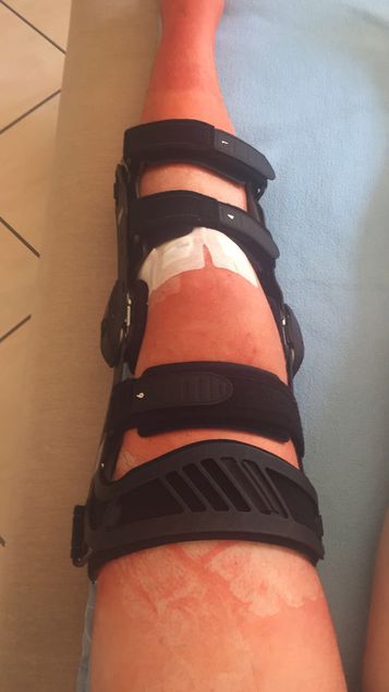 Metzinger Knie